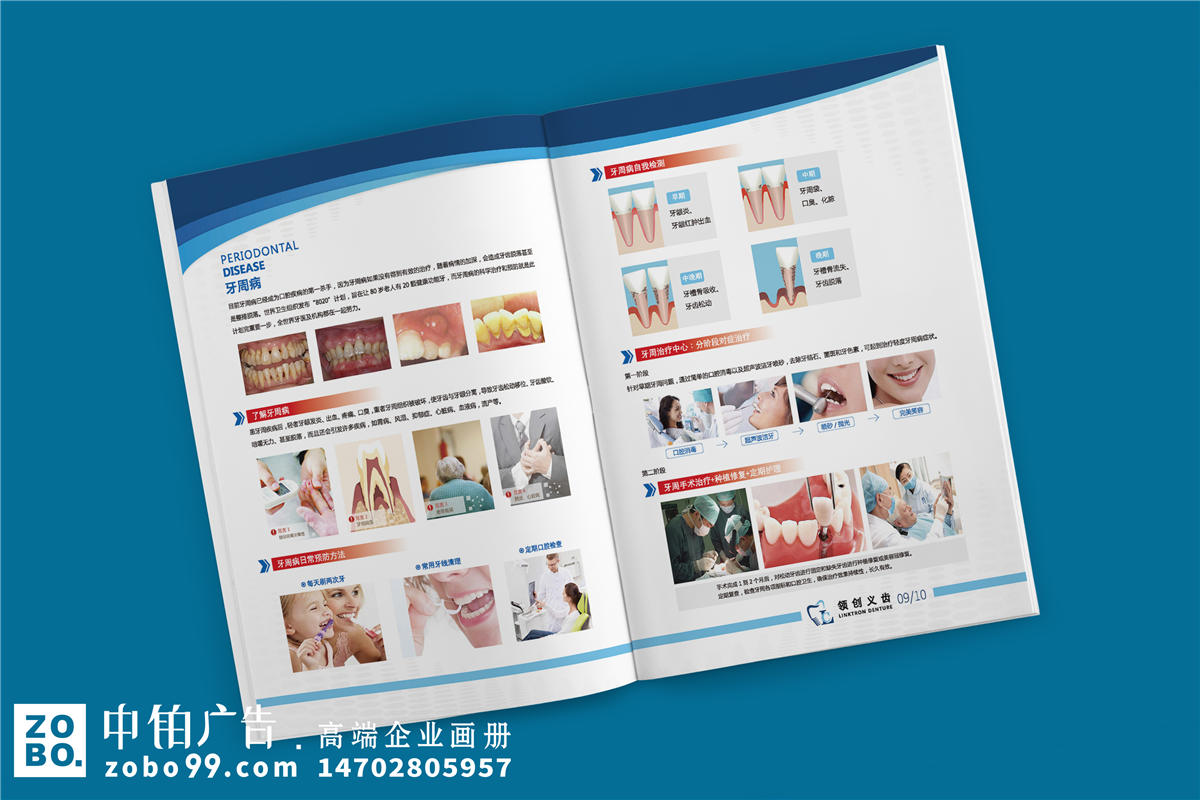 义齿产品宣传手册-义齿加工厂宣传册