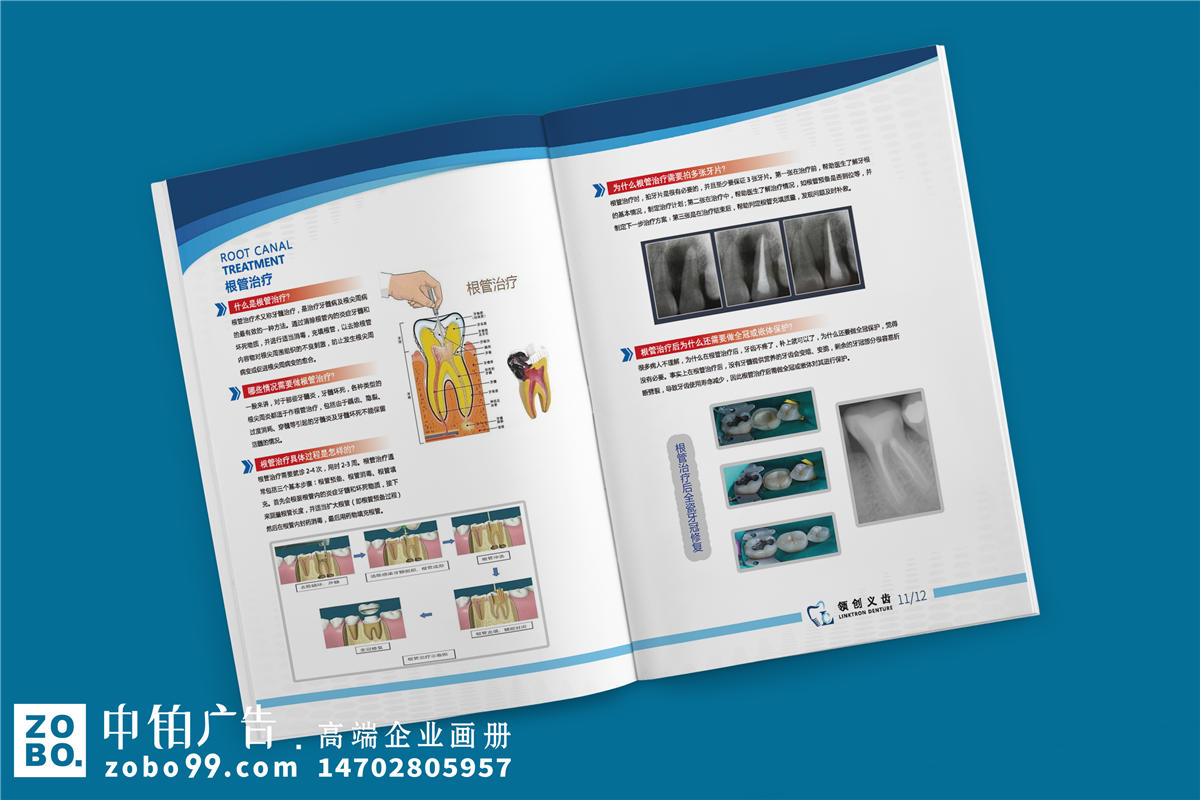 义齿产品宣传手册-义齿加工厂宣传册